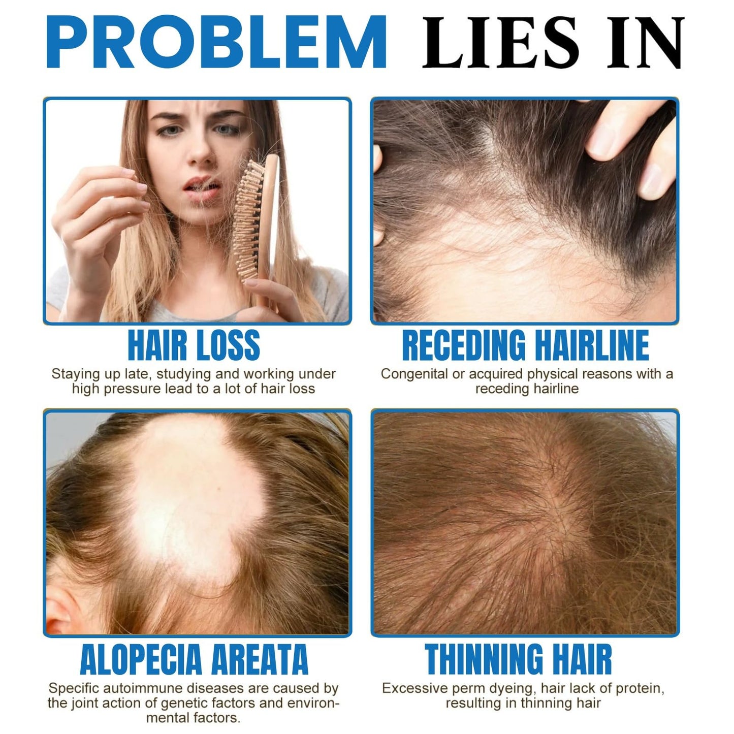 SingHao Scalp Cooling Hair Ampoule,H/air Growth Serum Roll On,S/calp Hair Ampoule,Hair Serum Helps to Ha/ir Growth,Hair Oil for Hair Growth,Hair Loss Treatment,Hair Growth Roller,Improve Scalp Health