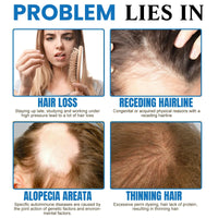 SingHao Scalp Cooling Hair Ampoule,H/air Growth Serum Roll On,S/calp Hair Ampoule,Hair Serum Helps to Ha/ir Growth,Hair Oil for Hair Growth,Hair Loss Treatment,Hair Growth Roller,Improve Scalp Health