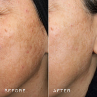 Medik8 Crystal Retinal 1 - Age-Defying Encapsulated Retinal Face Serum - Smoothing, Firming, Brightening & Decongesting - Improves Wrinkles & Hyperpigmentation - All Skin Types