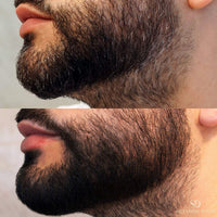 Mens Hair Dye Salvathor Duran - 20 Applications - Beard Dye - Natural Hair Dye - Hair Dye For Men - Mens Beard Dye - Beard Dye Black - Gradual or Complete Changement in the First Application - 250 ml.