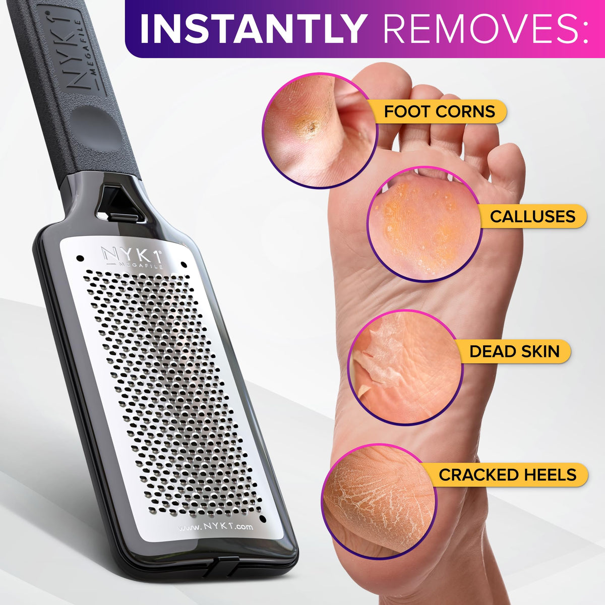 NYK1 RUSTPROOF Foot File Callus Remover for Feet with Catcher | XL Size