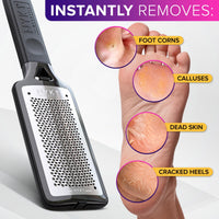 NYK1 RUSTPROOF Foot File Callus Remover for Feet with Catcher | XL Size