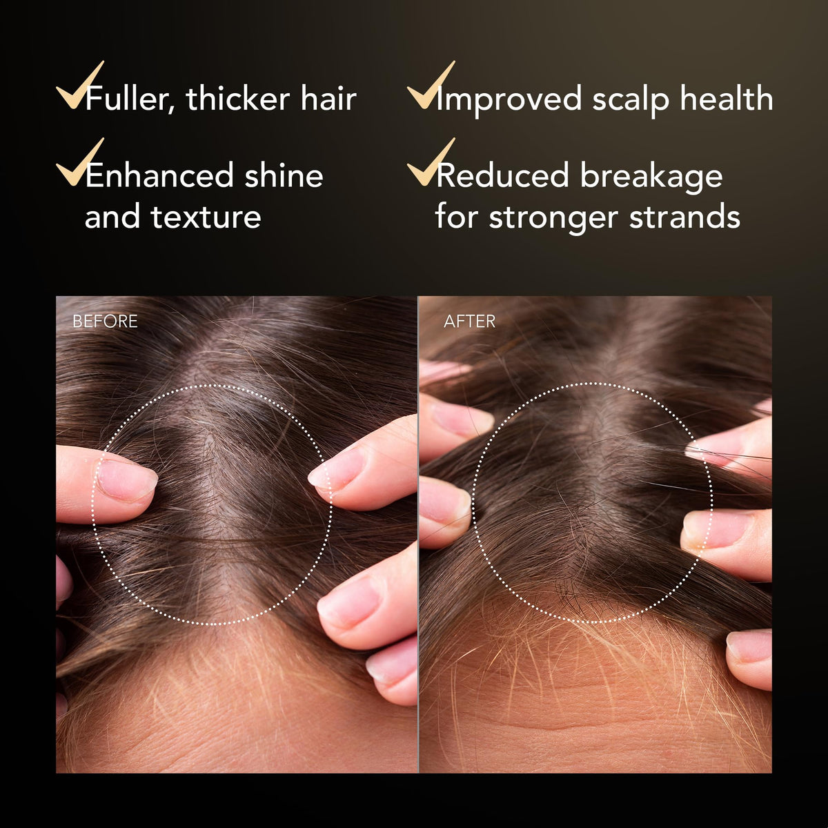 FAQ Scalp Recovery & Thick Hair Probiotic Serum with Red Clover Extract and Centella Asiatica - Repair Treatment - Thickening Serum for Growth