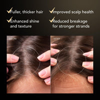 FAQ Scalp Recovery & Thick Hair Probiotic Serum with Red Clover Extract and Centella Asiatica - Repair Treatment - Thickening Serum for Growth