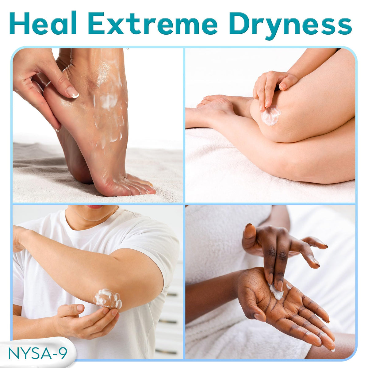 NYSA-9 Ultra-Hydrating 40% Urea Foot Cream 250 ml/8.5oz Plus 0.5% Salicylic Acid for Dry, Cracked Feet, Heels & Hands, Intensive Moisturizer & Skin Barrier Repair for Calluses & Psoriasis by Nysa-9