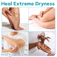 NYSA-9 Ultra-Hydrating 40% Urea Foot Cream 250 ml/8.5oz Plus 0.5% Salicylic Acid for Dry, Cracked Feet, Heels & Hands, Intensive Moisturizer & Skin Barrier Repair for Calluses & Psoriasis by Nysa-9