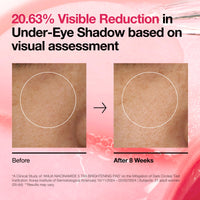 ANUA Anua Niacinamide 5 TXA Toner Pads – Hydrating Facial Care for Even-Looking Skin Tone & Daily Radiance Care (210ml, 60 Pads)