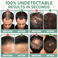 Magik Fibres Hair Fibres for Men and Women, Premium Keratin Hairline Powder for Thinning Hair, Adds Instant Volume for a Natural Look, Sweat Resistant, No Clumps, 27.5g Bottle (Medium Brown)