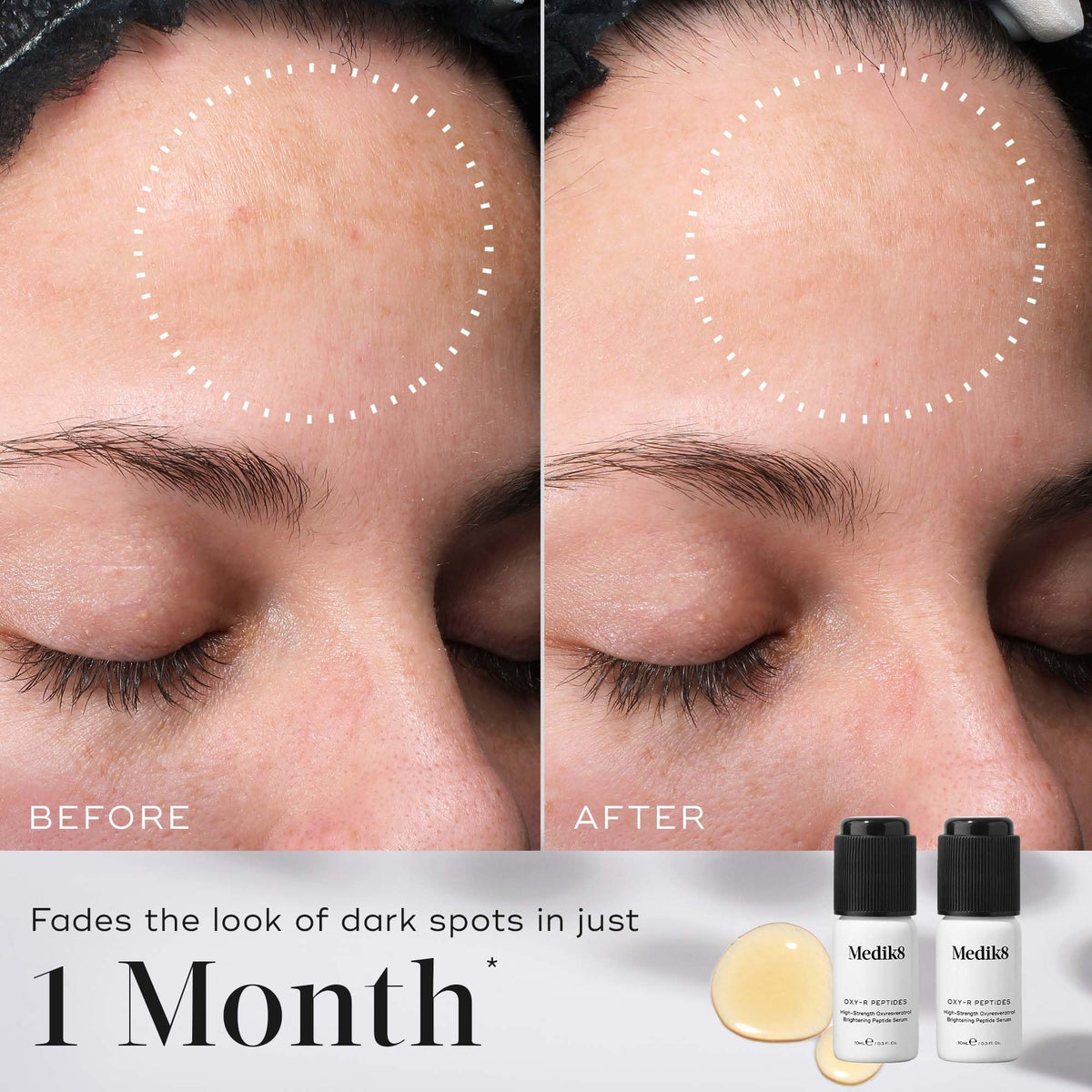 Medik8 Oxy-R Peptides - High-Strength 1% Oxyresveratrol Brightening Peptide Serum With Hyaluronic Acid - Brighten Dark Spots & Discolouration - 2 x 10ml