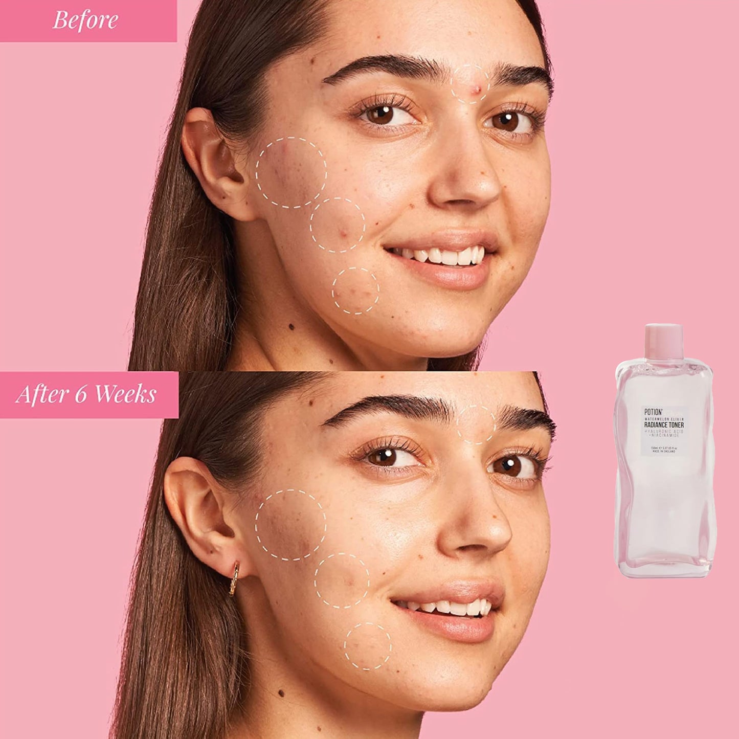 Katsy Style Watermelon Elixir Radiance Toner | Hydrating & Brightening Face Toner with Hyaluronic Acid & Niacinamide | Refreshing & Plumping Skincare 150ml