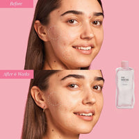 Katsy Style Watermelon Elixir Radiance Toner | Hydrating & Brightening Face Toner with Hyaluronic Acid & Niacinamide | Refreshing & Plumping Skincare 150ml
