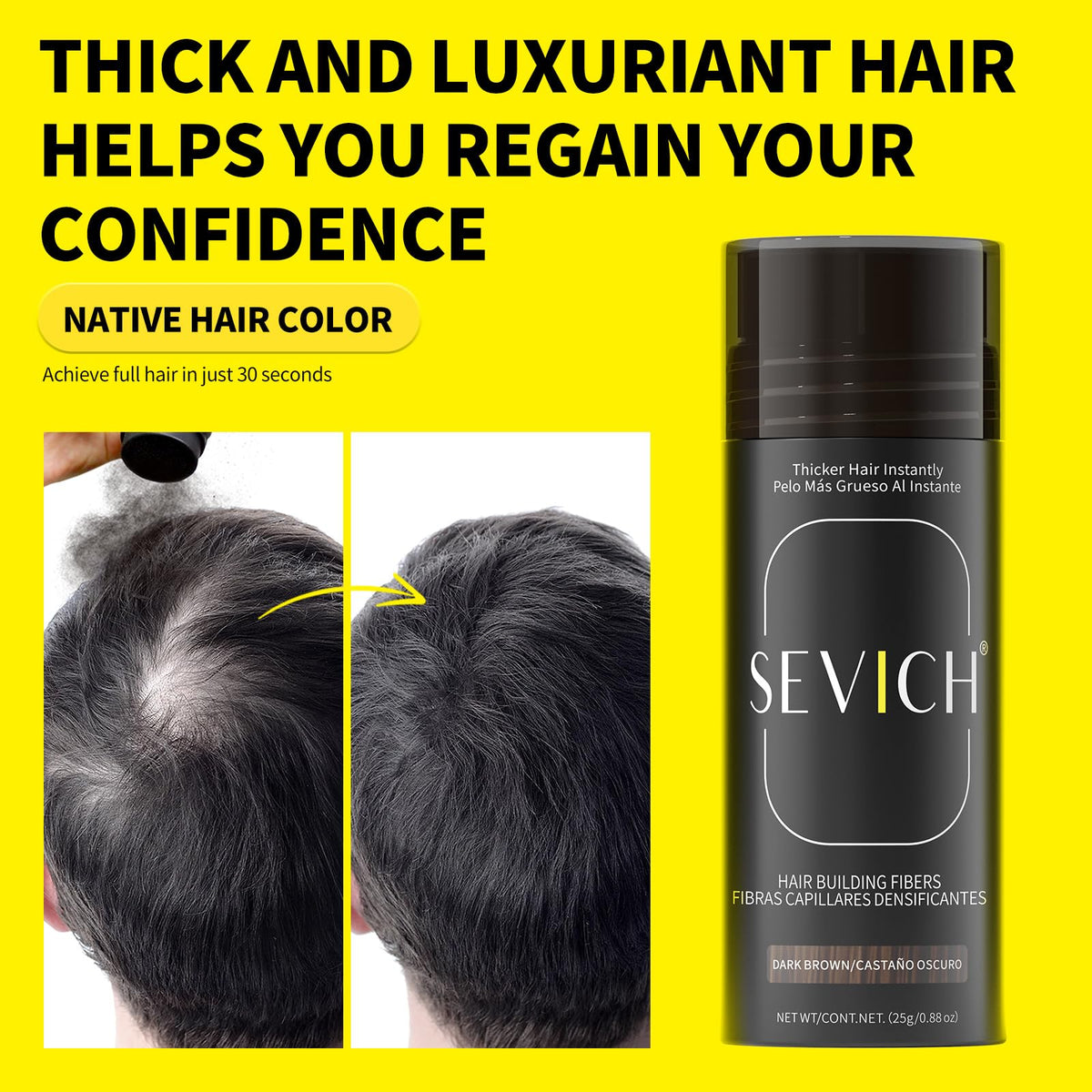 SEVICH Hair Building Fibers - Instant Hair Thickener for Thinning Hair Loss, Natural Keratin Powder for Men Women, Black 25g/0.88oz