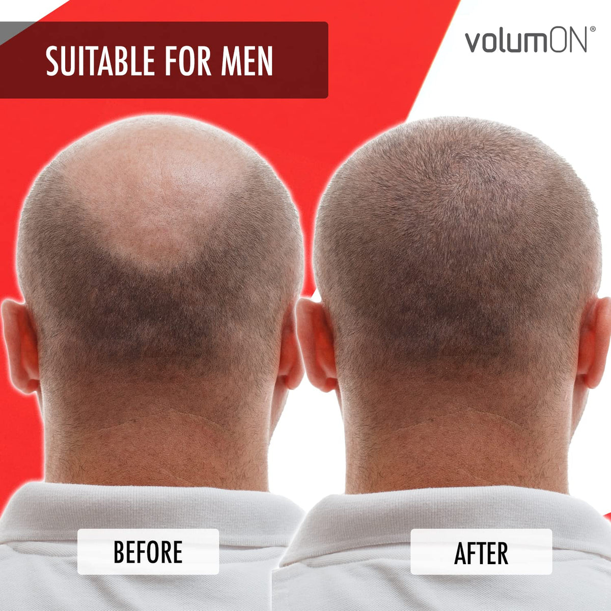 Volumon Professional Hair Building Fibres- Hair Loss Concealer- KERATIN- BLACK 28g- Get Upto 30 Uses