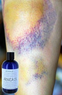 wellmadefairtrade Arnica Bruise Cream Arnica Oil for Bruising Arnica Massage Oil Arnica Massage Balm Made in Yorkshire (120ml Cream)