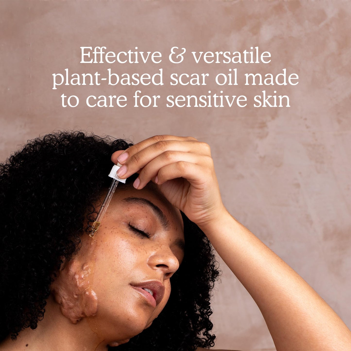 Balmonds Rosehip Scar Oil 50ml - 100% Natural Blend of Nourishing Oils - Helps Improve The Appearance of Scars, Uneven Skin Tone, Acne Scars & Stretch Marks - Hydrate, Nourish and Moisturise