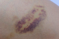 wellmadefairtrade Arnica Bruise Cream Arnica Oil for Bruising Arnica Massage Oil Arnica Massage Balm Made in Yorkshire (120ml Cream)