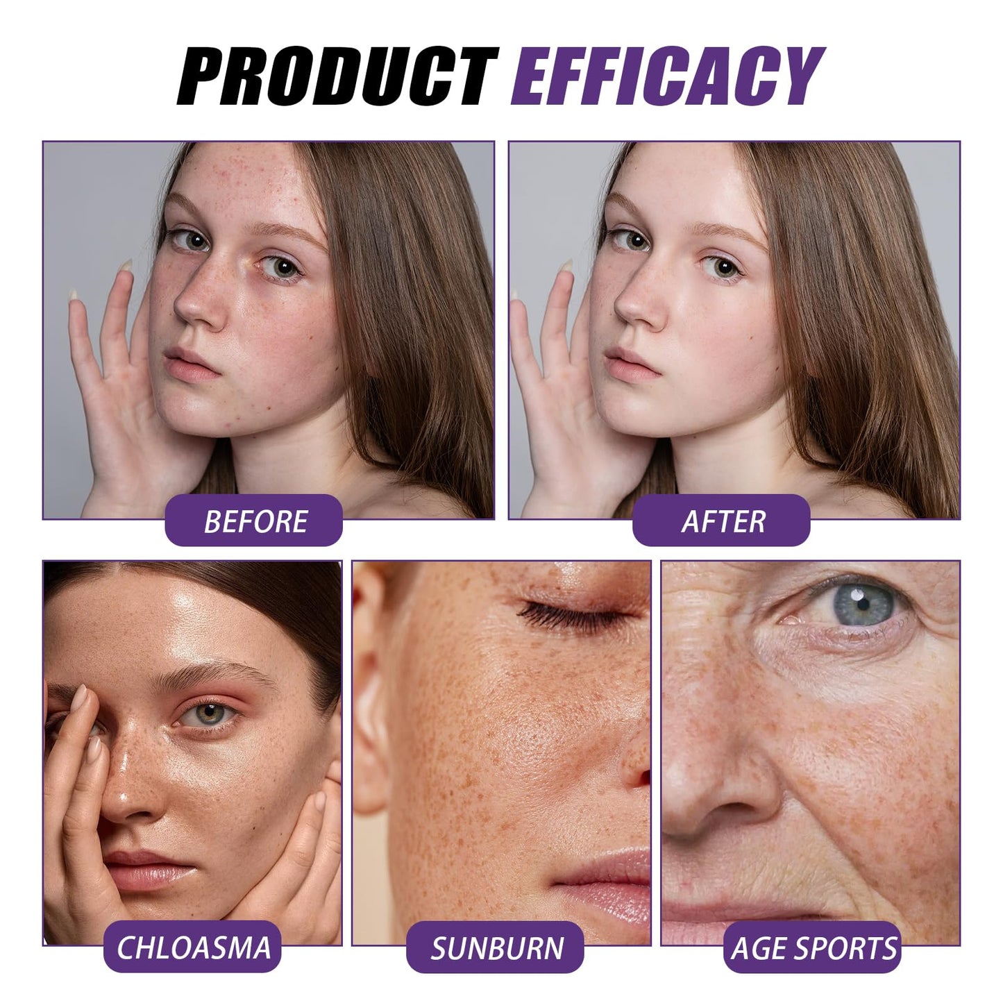 Katslyn Skin Tightening Cream for Face