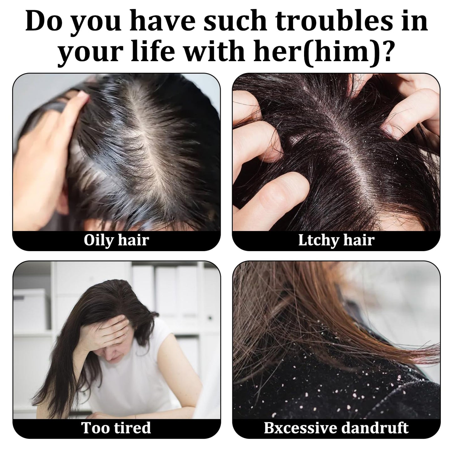 MADGININE 4 Pcs Dandruff Comb Psoriasis Comb Lice Comb Head Lice Comb Scalp Comb Multifunctional Hair Beauty Tool for Women and Men Scalp Massage Refreshing Promotes Scalp Health and Shiny Hair