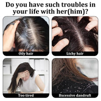 MADGININE 4 Pcs Dandruff Comb Psoriasis Comb Lice Comb Head Lice Comb Scalp Comb Multifunctional Hair Beauty Tool for Women and Men Scalp Massage Refreshing Promotes Scalp Health and Shiny Hair