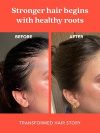 THE LIVING CO. THE LIVING CO Shikakai + Bhringraj Stimulating Hair Oil For Hair Growth - 100ml