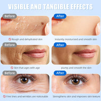 Pothenika Hydrating Hyaluronic Acid, Anti-Aging Hyaluronic Acid Serum for Face, Collagen Face Moisturiser for Dry and Dull Skin, Single-Use Vials Skincare Face Serum, Reduce Spots (30pcs)