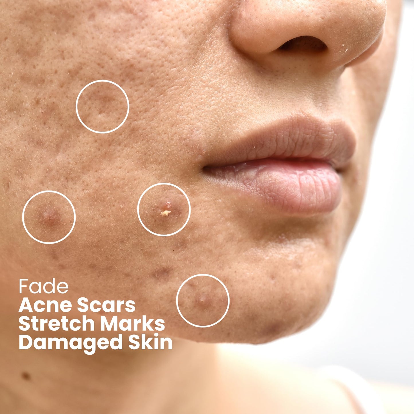 Ammuri Snail Collagen Serum Snail Secret Filtrate 96%, Bioactive Snail Skin Repair Serum Snail Mucin, Snail Secretion Anti-Ageing, Hyaluronic Acid Essence for All Skin Types