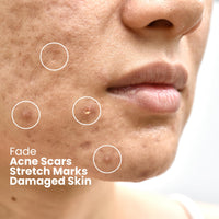 Ammuri Snail Collagen Serum Snail Secret Filtrate 96%, Bioactive Snail Skin Repair Serum Snail Mucin, Snail Secretion Anti-Ageing, Hyaluronic Acid Essence for All Skin Types