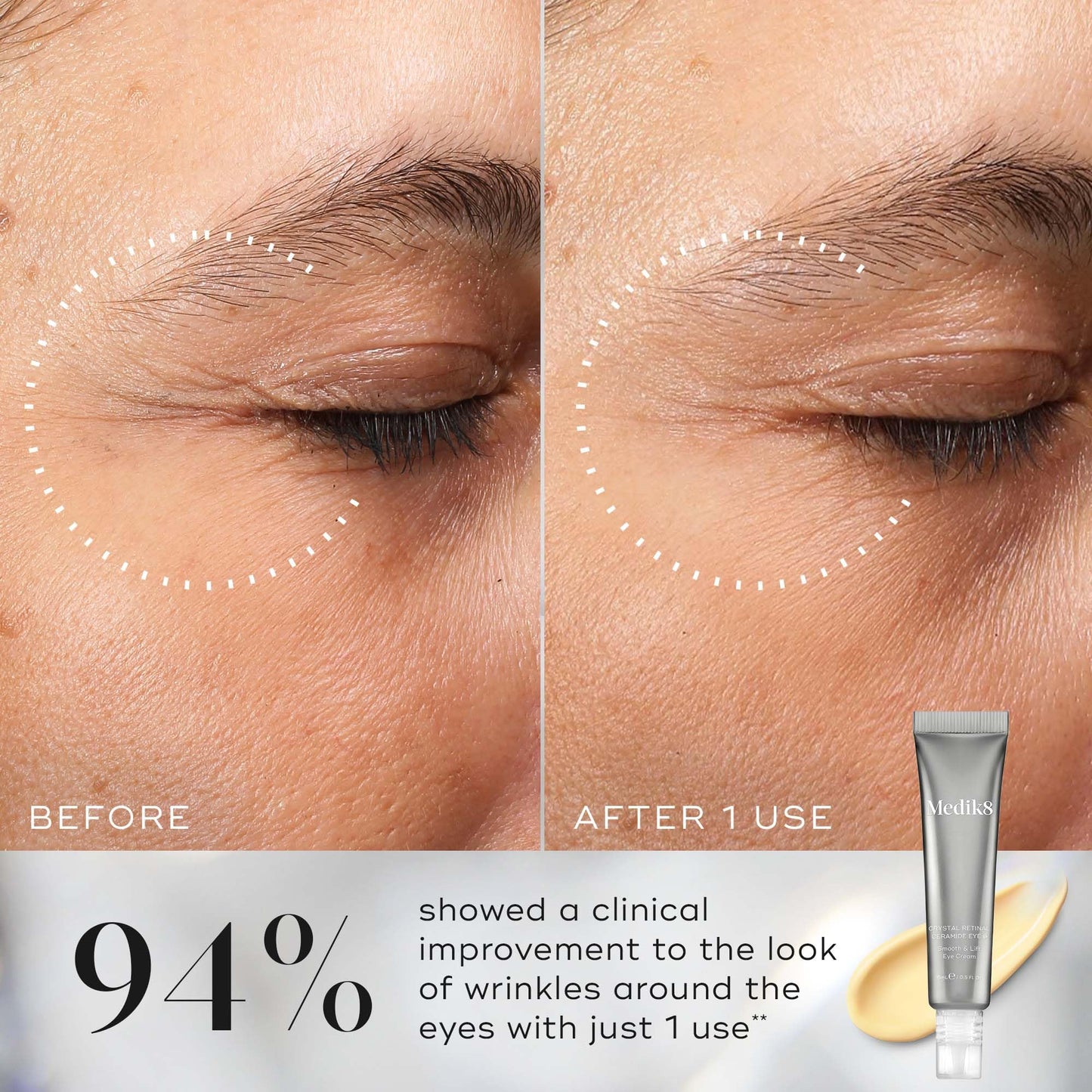 Medik8 Crystal Retinal Ceramide 6 Eye Cream - Anti Ageing & Anti Wrinkle - Smooth & Lift Eye Cream - 0.06% Retinal Strength - 11x Faster than Retinol - For Regular Vitamin A Users - 15ml