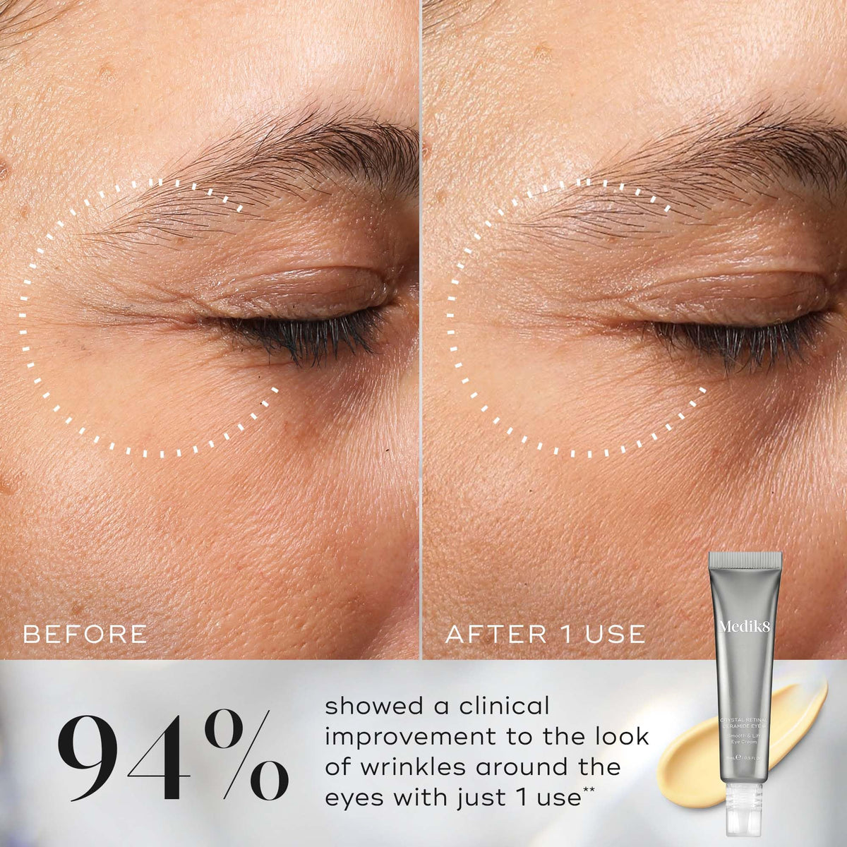 Medik8 Crystal Retinal Ceramide 3 Eye Cream - Anti Ageing & Anti Wrinkle - Smooth & Lift Eye Cream - 0.03% Retinal Strength - 11x Faster than Retinol - For New Vitamin A Users - 15ml