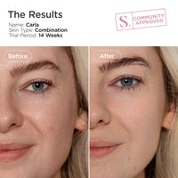 SCULPTED by Aimee Connolly HydraBright Illuminating Serum from Sculpted by Aimee 50ml – Vitamin C & Anti-Oxidant Rich Formula for Dull, Uneven Skin, Fine Lines and Wrinkles