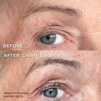 WUNDERBROW Wunderbrow Growth Enhancer Brow & Lash Serum, 2-in-1 Growth Serum For Fuller, Thicker, Healthier Brows & Lashes, Clinically Tested Formula, Visible Results in 6-8 weeks