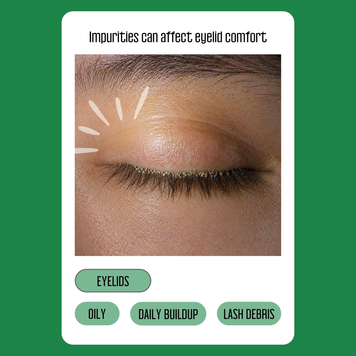 PURELID Tea Tree Eyelid Wipes – 100 Tea Tree Oil Eye Wipes for People with Dry Eyes & Allergies – Gentle Eyelid Cleanser with Hyaluronic Acid – Individually Wrapped & Biodegradable