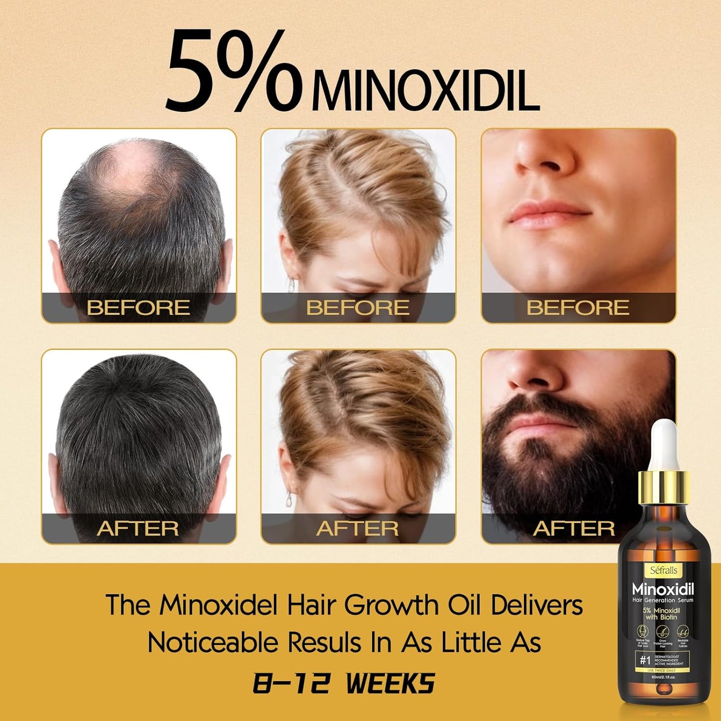 5% Minoxidil Hair Growth Serum Oil For Men and Women, Biotin Hair Serum, Prevent Scalp Hair Loss, 60 ml / 2.11 fl.oz