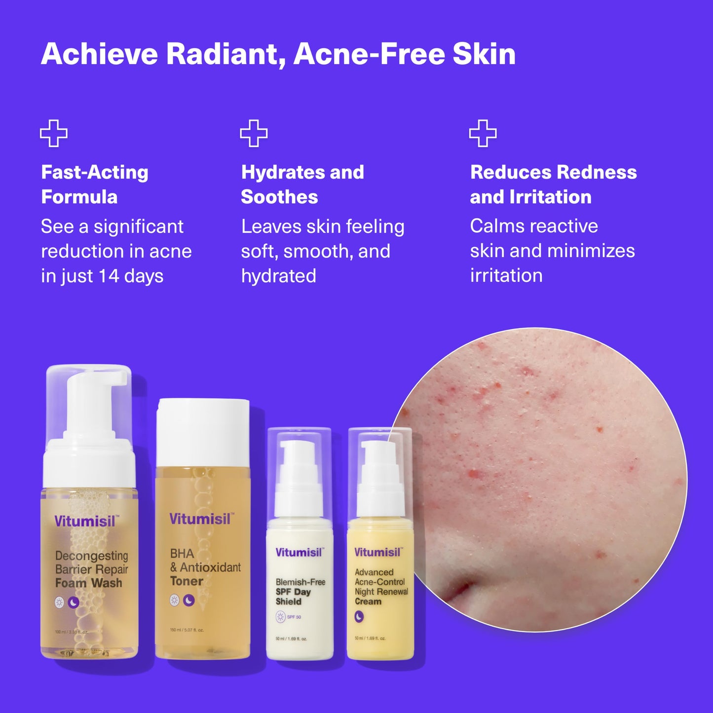 Dermz Acne Treatment - Acne Cream, SPF Face Protection, Face wash & Toner - Set of 4