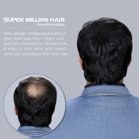 Super Million Hair Fibres - 10g - 15g - 20g - 25g - 40g. (10g, No.67 Natural Blonde)