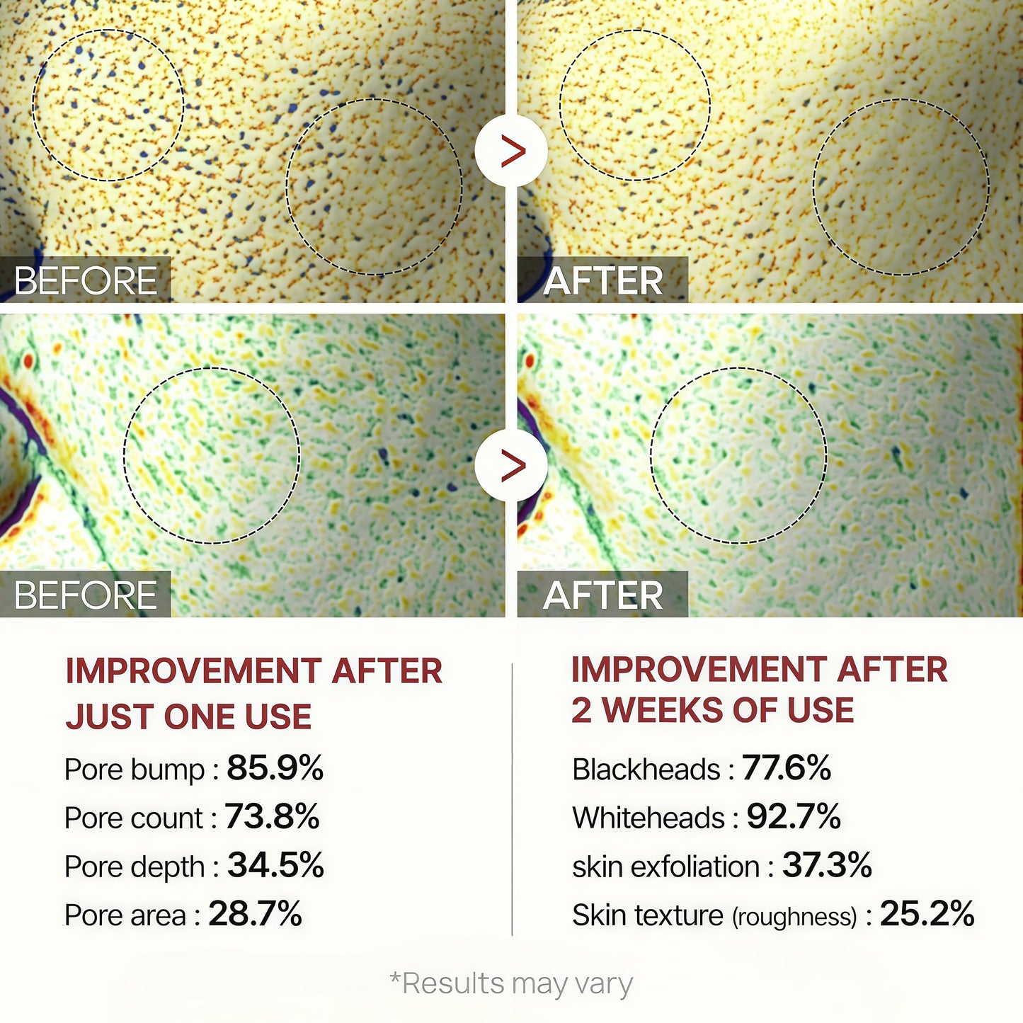 Curlady ANGEL SILK Peel Shot Glow Rice Ampoule Duo, 2025 Upgrade Black and White Rice Exfoliate, Gentle Peel, Pore Minimizing, Exfoliating Face and Body Scrub for All Skin Types