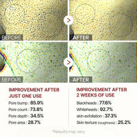 Curlady ANGEL SILK Peel Shot Glow Rice Ampoule Duo, 2025 Upgrade Black and White Rice Exfoliate, Gentle Peel, Pore Minimizing, Exfoliating Face and Body Scrub for All Skin Types