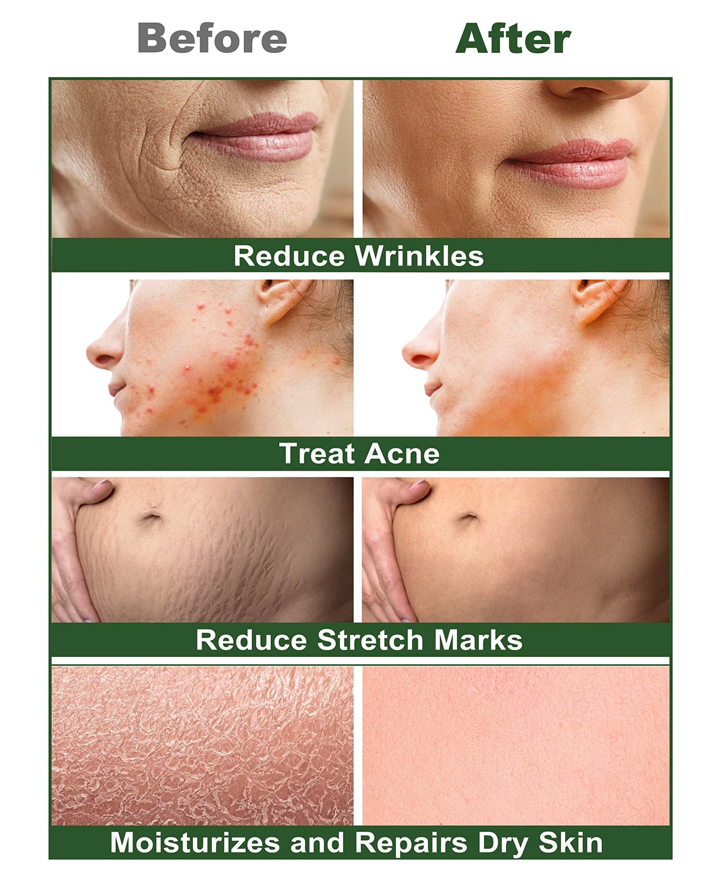 Castor Oil,2 Packs w/Free Lash&Brow Brushes&E-Book,100% Pure Hair Oil for Eyebrow Lash Eyelash Beard Growth Serum Dry Hair Skin Care Essential Oils,Gifts for Women Men Mum Wife Her