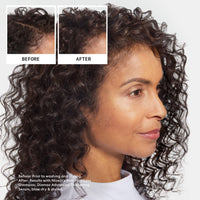 NIOXIN Nioxin Anti-Hair Loss Shampoo - Shampoo for Hair Loss - Hair Loss Treatment for Women & Men - With Caffeine & Niacinamide (240ml)