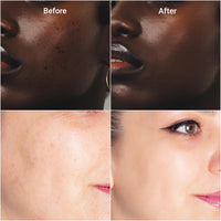 Elegant Organic Solutions Dark Spot Remover Serum - Brighten & Glow with Vitamin C, Kojic Acid, Tranexamic Acid & Niacinamide - Hydrates, Evens Tone, Squalane, Organic, 50ml