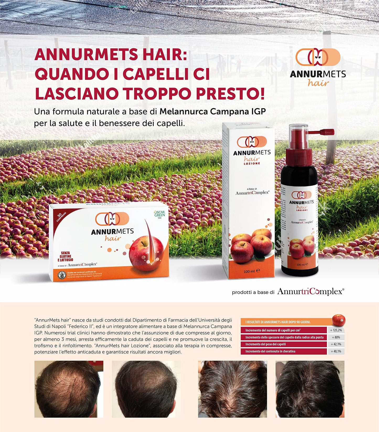 NGN HEALTHCARE-NEW GEN.NUT.Srl Annurmets Hair Tablets, No Color, 60 Pieces