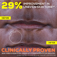Glow Hub The Scar Slayer Facial Serum with Vitamin C for Anti-Pigmentation and Blemish Prone Skin 30ml